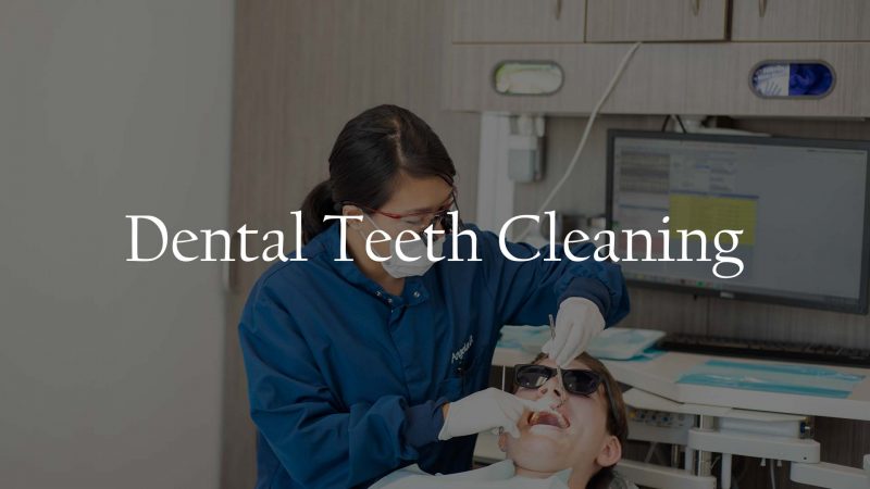 Dental Teeth Cleaning Service Houston