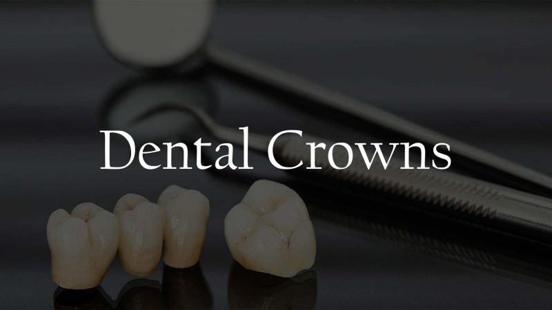 Dental Crowns Service Houston