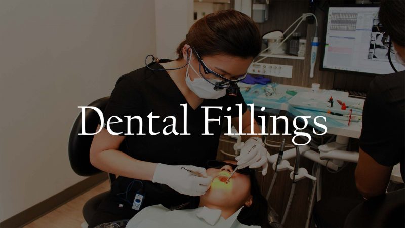 Dental Cavity Tooth Filling Service Houston 