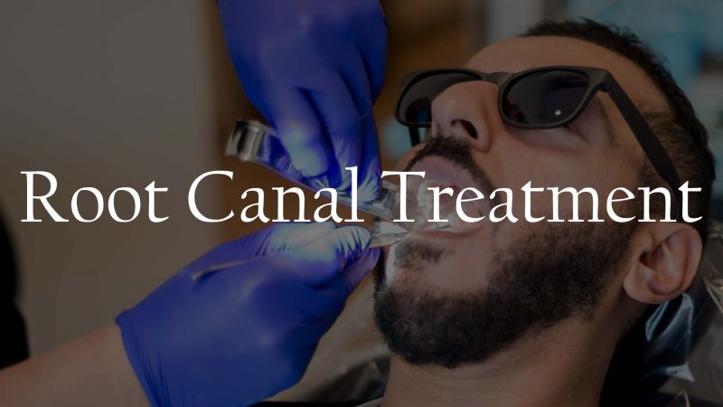 Root Canal Treatment