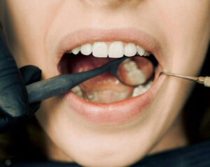 Dentist Open on Saturday